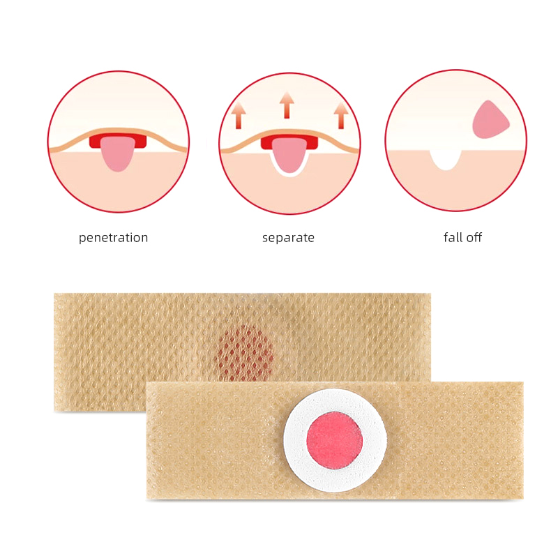 6PCS Foot Care Sticker Patch R - Detox Foot Patch ulasan dan harga